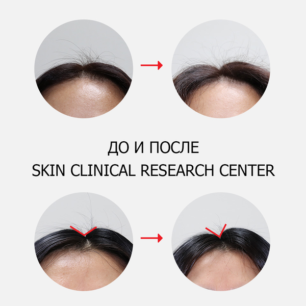 Шампунь против выпадения волос Dr.FORHAIR Folligen Shampoo, 500мл 8809485531038 фото