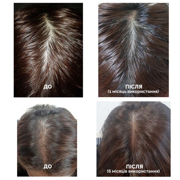 Стимулирующий тоник для роста волос Dr.FORHAIR Folligen Tonic, 120мл 8809485531502 фото