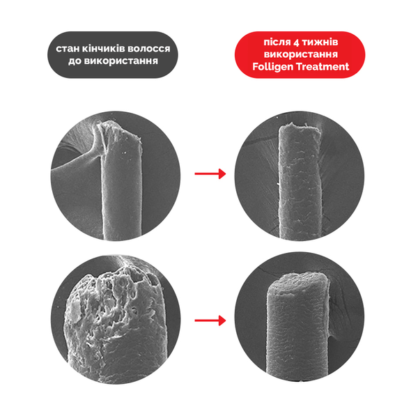 Кондиционер для волос Dr.FORHAIR Folligen Treatment , 200мл 8809485531311 фото